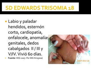  Labio y paladar
hendidos, esternón
corto, cardiopatía,
onfalocele, anomalías
genitales, dedos
cabalgados II / III y
V/IV.Vivió 60 días.
 Fuente: HEG 2007. Por MA Hinojosa)
 