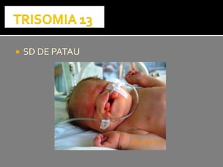  SD DE PATAUSD DE PATAU
 