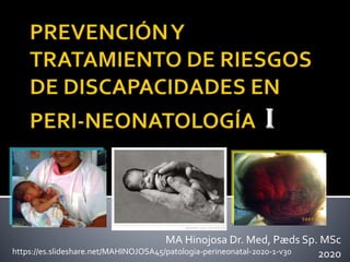 MA Hinojosa Dr. Med, Pæds Sp. MSc
2020https://es.slideshare.net/MAHINOJOSA45/patologia-perineonatal-2020-1-v30
 