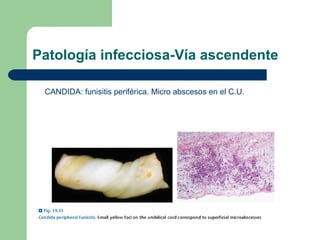 Patologia placentaria | PPT