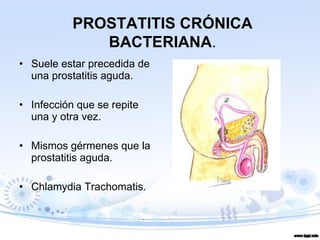 Suele estar precedida de una prostatitis aguda. Infección que se repite una y otra vez.  Mismos gérmenes que la prostatitis aguda. Chlamydia Trachomatis. PROSTATITIS CRÓNICA BACTERIANA . 