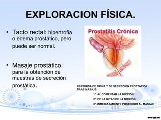 EXPLORACION FÍSICA. Tacto rectal:  hipertrofia o edema prostático, pero puede ser normal . Masaje prostático :  para la obtención de muestras de secreción prostática . RECOGIDA DE ORINA Y DE SECRECION PROSTATICA TRAS MASAJE: 1º: AL COMENZAR LA MICCIÓN. 2º: DE LA MITAD DE LA MICCIÓN. 3º. INMEDIATAMENTE POSTERIOR AL MASAJE 