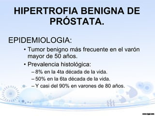 HIPERTROFIA BENIGNA DE PRÓSTATA. EPIDEMIOLOGIA: Tumor benigno más frecuente en el varón mayor de 50 años. Prevalencia histológica: 8% en la 4ta década de la vida. 50% en la 6ta década de la vida. Y casi del 90% en varones de 80 años. 