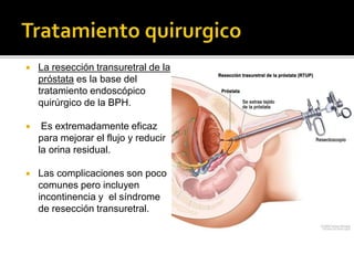  La resección transuretral de la
próstata es la base del
tratamiento endoscópico
quirúrgico de la BPH.
 Es extremadamente eficaz
para mejorar el flujo y reducir
la orina residual.
 Las complicaciones son poco
comunes pero incluyen
incontinencia y el síndrome
de resección transuretral.
 