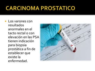  Los varones con
resultados
anormales en el
tacto rectal o con
elevación en las PSA
tienen indicación
para biopsia
prostática a fin de
establecer que
existe la
enfermedad.
 