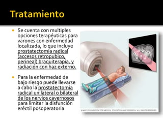  Se cuenta con multiples
opciones terapéuticas para
varones con enfermedad
localizada, lo que incluye
prostatectomia radical
(accesos retropubico,
perineal) braquiterapia, y
radiación con haz externo.
 Para la enfermedad de
bajo riesgo puede llevarse
a cabo la prostatectomia
radical unilateral o bilateral
de los nervios cavernosos
para limitar la disfunción
eréctil posoperatoria
 