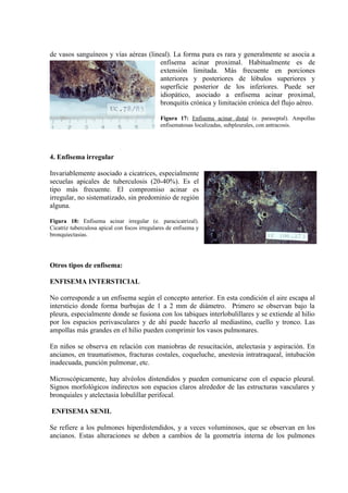 de vasos sanguíneos y vías aéreas (lineal). La forma pura es rara y generalmente se asocia a
                                       enfisema acinar proximal. Habitualmente es de
                                       extensión limitada. Más frecuente en porciones
                                       anteriores y posteriores de lóbulos superiores y
                                       superficie posterior de los inferiores. Puede ser
                                       idiopático, asociado a enfisema acinar proximal,
                                       bronquitis crónica y limitación crónica del flujo aéreo.

                                              Figura 17: Enfisema acinar distal (e. paraseptal). Ampollas
                                              enfisematosas localizadas, subpleurales, con antracosis.




4. Enfisema irregular

Invariablemente asociado a cicatrices, especialmente
secuelas apicales de tuberculosis (20-40%). Es el
tipo más frecuente. El compromiso acinar es
irregular, no sistematizado, sin predominio de región
alguna.

Figura 18: Enfisema acinar irregular (e. paracicatrizal).
Cicatriz tuberculosa apical con focos irregulares de enfisema y
bronquiectasias.




Otros tipos de enfisema:

ENFISEMA INTERSTICIAL

No corresponde a un enfisema según el concepto anterior. En esta condición el aire escapa al
intersticio donde forma burbujas de 1 a 2 mm de diámetro. Primero se observan bajo la
pleura, especialmente donde se fusiona con los tabiques interlobulillares y se extiende al hilio
por los espacios perivasculares y de ahí puede hacerlo al mediastino, cuello y tronco. Las
ampollas más grandes en el hilio pueden comprimir los vasos pulmonares.

En niños se observa en relación con maniobras de resucitación, atelectasia y aspiración. En
ancianos, en traumatismos, fracturas costales, coqueluche, anestesia intratraqueal, intubación
inadecuada, punción pulmonar, etc.

Microscópicamente, hay alvéolos distendidos y pueden comunicarse con el espacio pleural.
Signos morfológicos indirectos son espacios claros alrededor de las estructuras vasculares y
bronquiales y atelectasia lobulillar perifocal.

ENFISEMA SENIL

Se refiere a los pulmones hiperdistendidos, y a veces voluminosos, que se observan en los
ancianos. Estas alteraciones se deben a cambios de la geometría interna de los pulmones
 