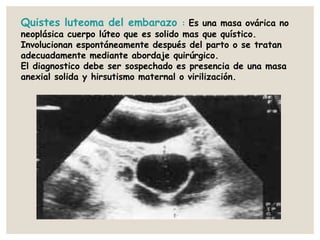 Quistes luteoma del embarazo : Es una masa ovárica no
neoplásica cuerpo lúteo que es solido mas que quístico.
Involucionan espontáneamente después del parto o se tratan
adecuadamente mediante abordaje quirúrgico.
El diagnostico debe ser sospechado es presencia de una masa
anexial solida y hirsutismo maternal o virilización.
 