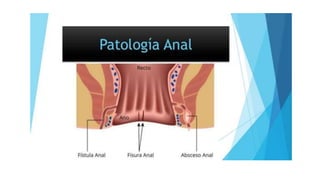 Patologia rectal