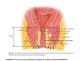Senos anales
SCHWARTZ. Principio de Cirugía. Malrotación congénita.9a ed. México: Editorial McGRAW-HILL
 