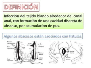 anatomia recto anal y absceso perianal