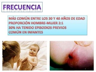 anatomia recto anal y absceso perianal