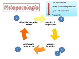 anatomia recto anal y absceso perianal