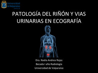 PATOLOGÍA DEL RIÑÓN Y VIAS
URINARIAS EN ECOGRAFÍA
Dra. Nadia Andrea Rojas
Becada I año Radiología
Universidad de Valparaíso
 