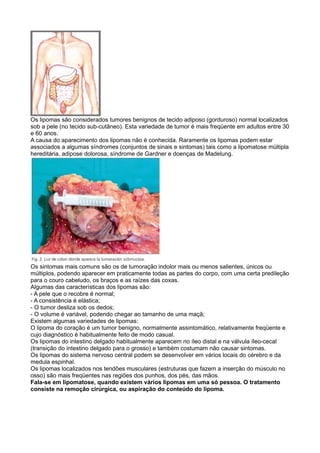 Os lipomas são considerados tumores benignos de tecido adiposo (gorduroso) normal localizados
sob a pele (no tecido sub-cutâneo). Esta variedade de tumor é mais freqüente em adultos entre 30
e 60 anos.
A causa do aparecimento dos lipomas não é conhecida. Raramente os lipomas podem estar
associados a algumas síndromes (conjuntos de sinais e sintomas) tais como a lipomatose múltipla
hereditária, adipose dolorosa, síndrome de Gardner e doenças de Madelung.




Os sintomas mais comuns são os de tumoração indolor mais ou menos salientes, únicos ou
múltiplos, podendo aparecer em praticamente todas as partes do corpo, com uma certa predileção
para o couro cabeludo, os braços e as raízes das coxas.
Algumas das características dos lipomas são:
- A pele que o recobre é normal;
- A consistência é elástica;
- O tumor desliza sob os dedos;
- O volume é variável, podendo chegar ao tamanho de uma maçã;
Existem algumas variedades de lipomas:
O lipoma do coração é um tumor benigno, normalmente assintomático, relativamente freqüente e
cujo diagnóstico é habitualmente feito de modo casual.
Os lipomas do intestino delgado habitualmente aparecem no íleo distal e na válvula íleo-cecal
(transição do intestino delgado para o grosso) e também costumam não causar sintomas.
Os lipomas do sistema nervoso central podem se desenvolver em vários locais do cérebro e da
medula espinhal.
Os lipomas localizados nos tendões musculares (estruturas que fazem a inserção do músculo no
osso) são mais freqüentes nas regiões dos punhos, dos pés, das mãos.
Fala-se em lipomatose, quando existem vários lipomas em uma só pessoa. O tratamento
consiste na remoção cirúrgica, ou aspiração do conteúdo do lipoma.
 