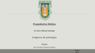 Propedéutica Médica
Dr. Haro Villareal Santiago
Imágenes de patologías
Alumna
Ana Carolina Güereca Muñoz
1
Grupo
42.2
 