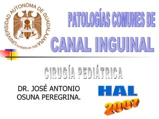 DR. JOSÉ ANTONIO OSUNA PEREGRINA. CANAL INGUINAL  PATOLOGÍAS COMUNES DE 2007 CIRUGÍA PEDIÁTRICA HAL 