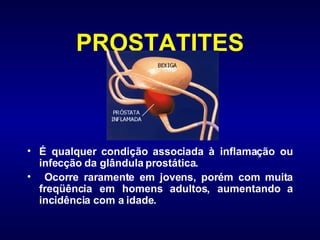 PROSTATITES É qualquer condição associada à inflamação ou infecção da glândula prostática. Ocorre raramente em jovens, porém com muita freqüência em homens adultos, aumentando a incidência com a idade.  