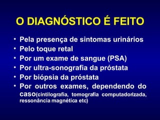 O DIAGNÓSTICO É FEITO Pela presença de sintomas urinários Pelo toque retal  Por um exame de sangue (PSA) Por ultra-sonografia da próstata  Por biópsia da próstata  Por outros exames, dependendo do caso (cintilografia, tomografia computadorizada, ressonância magnética etc) 