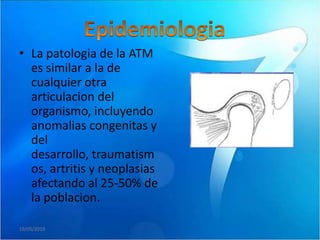 • La patologia de la ATM
  es similar a la de
  cualquier otra
  articulacion del
  organismo, incluyendo
  anomalias congenitas y
  del
  desarrollo, traumatism
  os, artritis y neoplasias
  afectando al 25-50% de
  la poblacion.

19/05/2010
 