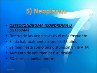 • OSTEOCONDROMA (CONDROMA U
  OSTEOMA)
• Dentro de las neoplasias es el más frecuente
• Se da habitualmente sobre los 25 años
• Se manifiesta como una disfunción en la ATM
• Aumento de volumen peri auricular
• RX: forma condilar anormal.

19/05/2010
 