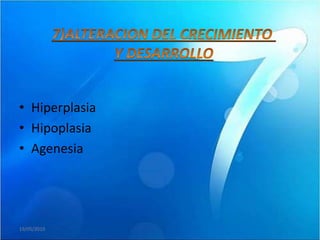 • Hiperplasia
• Hipoplasia
• Agenesia




19/05/2010
 