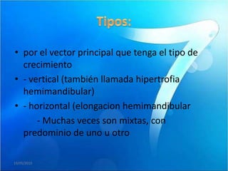 • por el vector principal que tenga el tipo de
  crecimiento
• - vertical (también llamada hipertrofia
  hemimandibular)
• - horizontal (elongacion hemimandibular
      - Muchas veces son mixtas, con
  predominio de uno u otro

19/05/2010
 