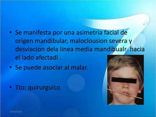 • Se manifesta por una asimetria facial de
  origen mandibular, maloclousion severa y
  desviacion dela linea media mandibualr hacia
  el lado afectadi .
• Se puede asociar al malar.

• Tto: quirurguico


19/05/2010
 