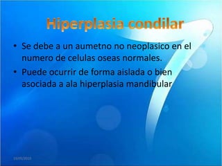 • Se debe a un aumetno no neoplasico en el
  numero de celulas oseas normales.
• Puede ocurrir de forma aislada o bien
  asociada a ala hiperplasia mandibular




19/05/2010
 