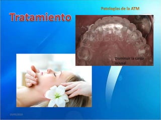 Disminuir la carga
             oclusal




19/05/2010
 