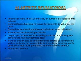 • Inflamación de la sinovial, donde hay un aumento de exudado intra
  articular
• Hay impotencia funcional en la cual hay aumento de volumen, con
  dolor
• Generalmente simétrica (ambas articulaciones se ven afectadas)
• Hay destrucción del cartílago articular
• Crepito: por la destrucción de cartílago articular, entonces queda
  contactando las dos superficies óseas
• Hay una erosión ósea que determina una perdida de la dimensión
  vertical posterior, hay una perdida de altura facial posterior, por lo
  que hay un tope molar prematuro y mordida abierta anterior
• Alteración sistémica


19/05/2010
 