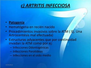 c) ARTRITIS INFECCIOSA


• Patogenia
• Hematógena en recién nacido
• Procedimientos invasivos sobre la ATM ( Ej. Una
  Artrocentésis mal efectuada)
• Estructuras adyacentes que por continuidad
  invadan la ATM como por ej:
      – Infecciones Odontogénicas
      – Infecciones Parotídeas
      – Infecciones en el oído medio

19/05/2010
 