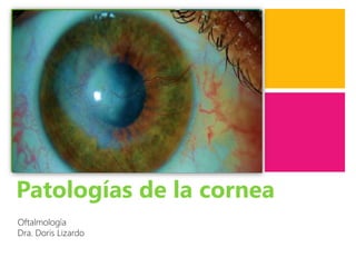 +
Patologías de la cornea
Oftalmología
Dra. Doris Lizardo
 