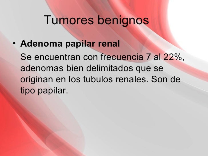 El medio público del tratamiento de la hernia intervertebral