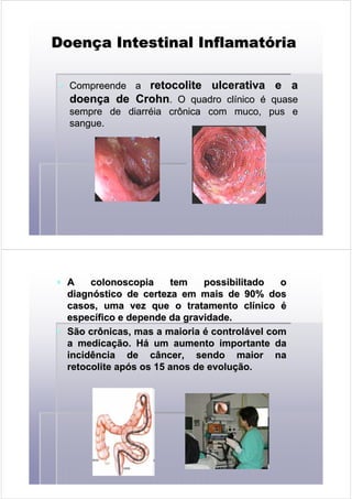 DoenDoençça Intestinal Inflamata Intestinal Inflamatóóriaria
Compreende aCompreende a retocoliteretocolite ulcerativaulcerativa e ae a
doendoençça dea de CrohnCrohn. O quadro cl. O quadro clííniconico éé quasequase
sempre de diarrsempre de diarrééia crônica com muco, pus eia crônica com muco, pus e
sangue.sangue.
AA colonoscopiacolonoscopia tem possibilitado otem possibilitado o
diagndiagnóóstico de certeza em mais de 90% dosstico de certeza em mais de 90% dos
casos, uma vez que o tratamento clcasos, uma vez que o tratamento clííniconico éé
especespecíífico e depende da gravidade.fico e depende da gravidade.
São crônicas, mas a maioriaSão crônicas, mas a maioria éé controlcontroláável comvel com
a medicaa medicaçção. Hão. Háá um aumento importante daum aumento importante da
incidência de câncer, sendo maior naincidência de câncer, sendo maior na
retocoliteretocolite apapóós os 15 anos de evolus os 15 anos de evoluçção.ão.
 