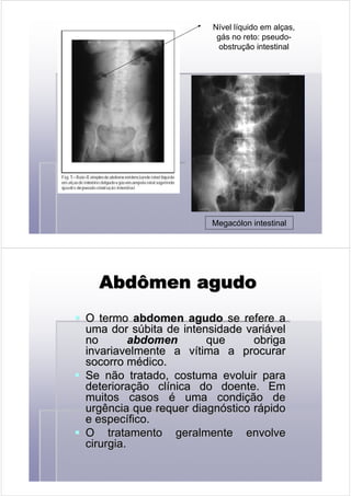 Nível líquido em alças,
gás no reto: pseudo-
obstrução intestinal
Megacólon intestinal
Abdômen agudoAbdômen agudoAbdômen agudoAbdômen agudoAbdômen agudoAbdômen agudoAbdômen agudoAbdômen agudo
O termoO termo abdomenabdomen agudoagudo se refere ase refere a
umauma dordor ssúúbita de intensidade varibita de intensidade variáávelvel
nono abdomeabdomenn que obrigaque obriga
invariavelmente a vinvariavelmente a víítima a procurartima a procurar
socorro msocorro méédico.dico.
Se não tratado, costuma evoluir paraSe não tratado, costuma evoluir para
deterioradeterioraçção clão clíínica do doente. Emnica do doente. Em
muitos casosmuitos casos éé uma condiuma condiçção deão de
urgência que requer diagnurgência que requer diagnóóstico rstico ráápidopido
e espece especíífico.fico.
O tratamento geralmente envolveO tratamento geralmente envolve
cirurgiacirurgia..
 