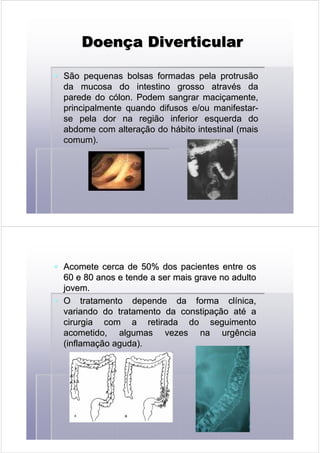 DoenDoenDoenDoenDoenDoenDoenDoenççççççççaaaaaaaa DiverticularDiverticularDiverticularDiverticularDiverticularDiverticularDiverticularDiverticular
São pequenas bolsas formadas pelaSão pequenas bolsas formadas pela protrusãoprotrusão
da mucosa do intestino grosso atravda mucosa do intestino grosso atravéés das da
parede do cparede do cóólon. Podem sangrar macilon. Podem sangrar maciççamente,amente,
principalmente quando difusos e/ou manifestarprincipalmente quando difusos e/ou manifestar--
se pela dor na região inferior esquerda dose pela dor na região inferior esquerda do
abdome com alteraabdome com alteraçção do hão do háábito intestinal (maisbito intestinal (mais
comum).comum).
Acomete cerca de 50% dos pacientes entre osAcomete cerca de 50% dos pacientes entre os
60 e 80 anos e tende a ser mais grave no adulto60 e 80 anos e tende a ser mais grave no adulto
jovem.jovem.
O tratamento depende da forma clO tratamento depende da forma clíínica,nica,
variando do tratamento da constipavariando do tratamento da constipaçção atão atéé aa
cirurgia com a retirada do seguimentocirurgia com a retirada do seguimento
acometido, algumas vezes na urgênciaacometido, algumas vezes na urgência
(inflama(inflamaçção aguda).ão aguda).
 