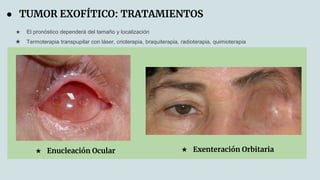 patologias-asociadas-a-anoftalmia-pr-tesis-pptx