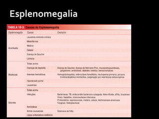 Esplenomegalia - > 14 cm
Volume – LxAPxTx0,523 > 480cm³
Ìndice esplênico – L x AP > 60cm²
 