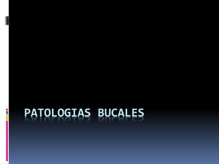PATOLOGIAS BUCALES
 