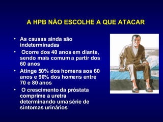       A HPB NÃO ESCOLHE A QUE ATACAR As causas ainda são indeterminadas Ocorre dos 40 anos em diante, sendo mais comum a partir dos 60 anos Atinge 50% dos homens aos 60 anos e 90% dos homens entre 70 e 80 anos O crescimento da próstata comprime a uretra determinando uma série de sintomas urinários                     