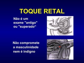 TOQUE RETAL Não compromete a masculinidade  nem é indigno Não é um exame "antigo" ou "superado“ 