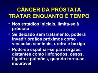 CÂNCER DA PRÓSTATA TRATAR ENQUANTO É TEMPO Nos estádios iniciais, limita-se à próstata Se deixado sem tratamento, poderá invadir órgãos próximos como vesículas seminais, uretra e bexiga Pode-se espalhar-se para órgãos distantes como linfonodos, ossos, fígado e pulmões, quando torna-se incurável 