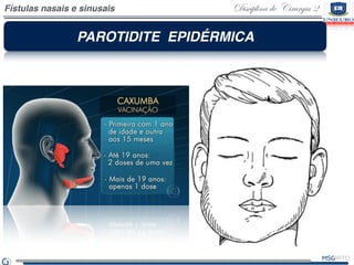 Patologias das glândulas salivares 2 | PDF
