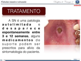 Disciplina de Cirurgia 2Fístulas nasais e sinusais
    A SN é uma patologia
a u t o l i m i t a d a e
d e s a p a r e c e
...