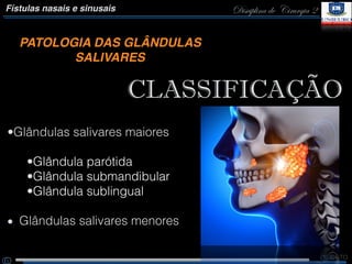 Disciplina de Cirurgia 2Fístulas nasais e sinusais
PATOLOGIA DAS GLÂNDULAS
SALIVARES
CLASSIFICAÇÃO
•Glândulas salivares maiores
Glândulas salivares menores
•Glândula parótida
•Glândula submandibular
•Glândula sublingual
 