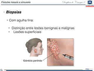 Disciplina de Cirurgia 2Fístulas nasais e sinusais
• Biopsias
• Com agulha ﬁna:
• Distinção entre lesões benignas e malign...