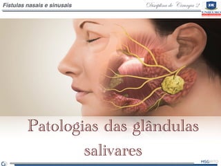 Disciplina de Cirurgia 2Fístulas nasais e sinusais
Patologias das glândulas
salivares
 