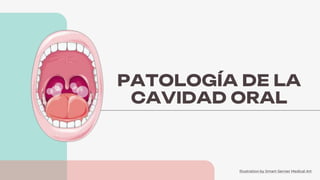 Illustration by Smart-Servier Medical Art
PATOLOGÍA DE LA
CAVIDAD ORAL
 