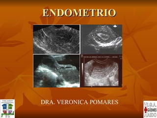 ENDOMETRIO DRA. VERONICA POMARES 